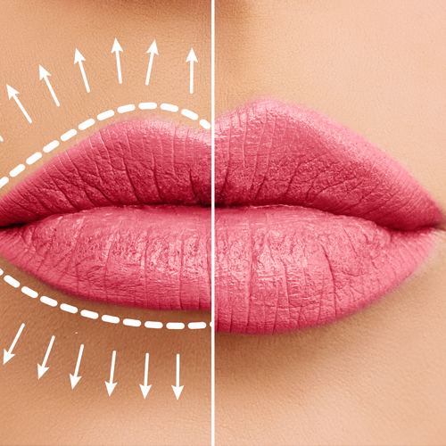 Kleine lippen voller maken met PMU Lip behandeling – Melissa Beauty Utrecht Kleine lippen voller maken met PMU Lip behandeling - Melissa Beauty Utrecht